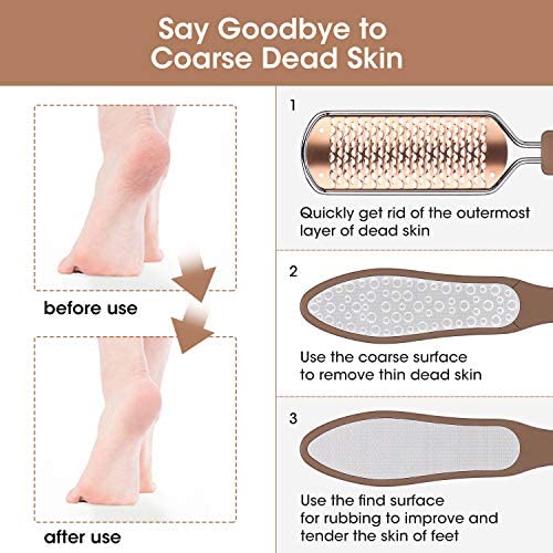 Oneleaf 2PCS Professional Pedicure Rasp Foot File Cracked Skin Corns Callus Remover for Extra Smooth and Beauty Foot … (Rose)